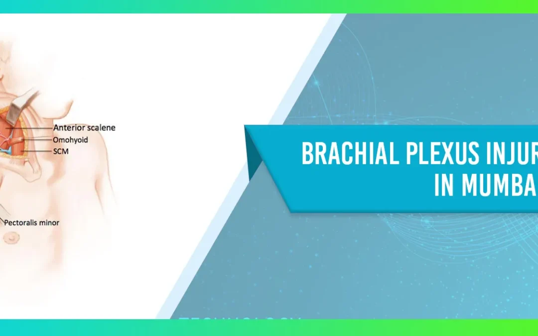 Brachial Plexus Injury Treatment in Mumbai