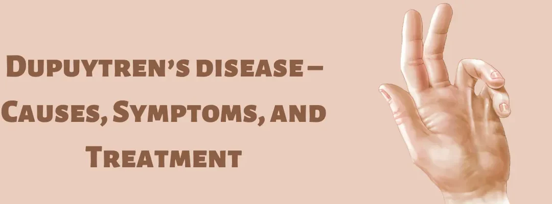 Dupuytren’s disease – Causes, Symptoms, and Treatment