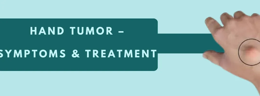 Hand Tumor – Symptoms & Treatment