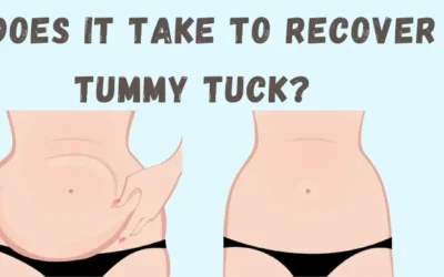 How long does it take to recover from a tummy tuck?