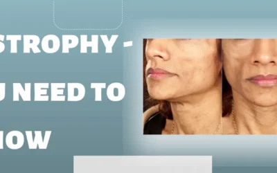 Lipodystrophy – All you need to know