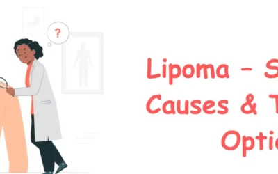 Lipoma – Symptoms, Causes & Treatment Options