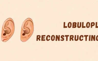 Lobuloplasty – Reconstructing The Earlobe