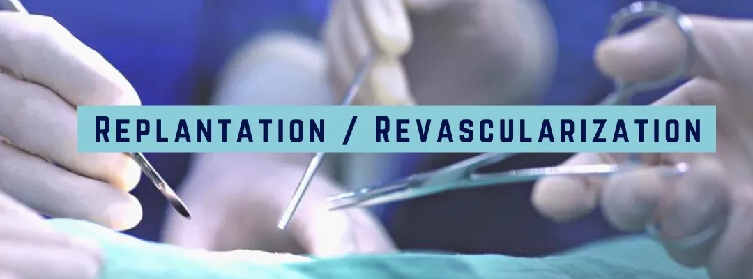 Replantation/Revascularization