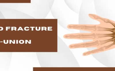 Scaphoid Fracture Non-Union