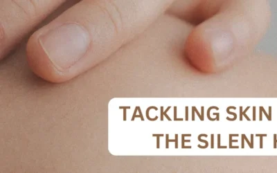 Tackling Skin Cancer – The Silent Killer