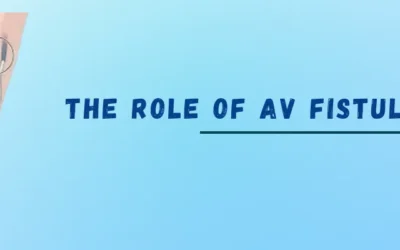 The Role Of AV fistula In Dialysis