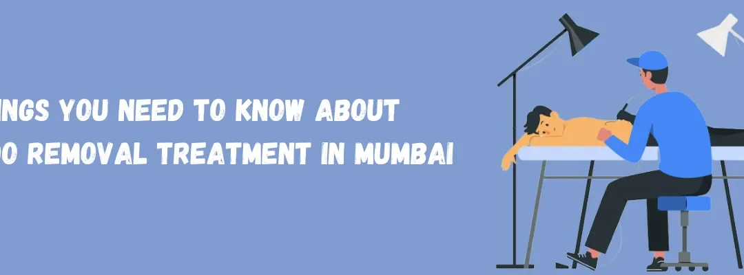 Things You Need To Know About Tattoo Removal Treatment in Mumbai