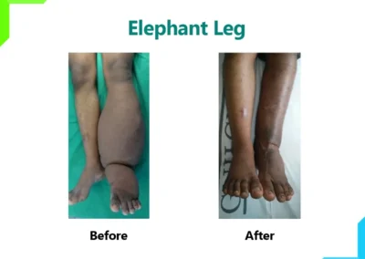 Elephant Leg