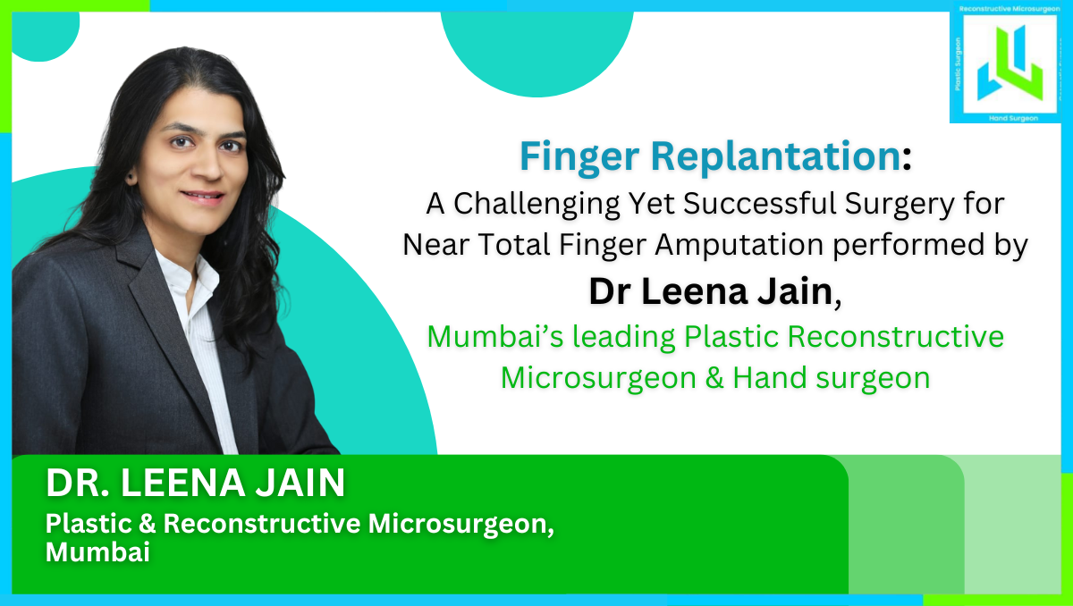 Finger Replantation, A Challenging Yet Successful Surgery For Near Total Finger Amputation Performed By Dr. Leena Jain, Mumbai’s Leading Plastic Reconstructive Microsurgeon & Hand Surgeon