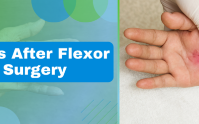 6 Weeks After Flexor Tendon Surgery
