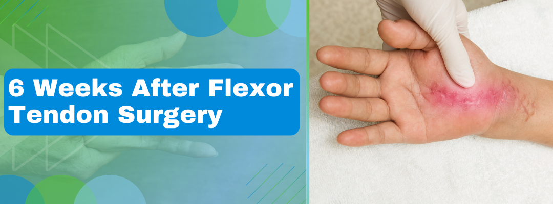 6 Weeks After Flexor Tendon Surgery