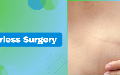 Expert Insights on Scarless Surgery: What You Need to Know